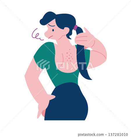 A woman suffering from eczema, hives, and back acne 137281010