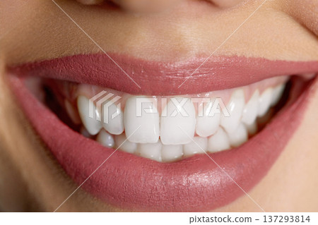 Perfect healthy teeth smile of a young woman. Teeth whitening. Dental clinic patient. Image symbolizes oral care dentistry, stomatology. 137293814