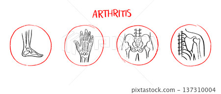 Arthritis Sketch Poster Arthritis Sketch Poster 137310004