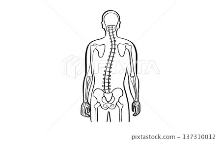 Scoliosis spine deformity 137310012