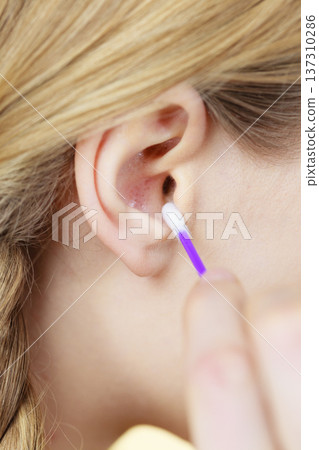 Woman cleaning ear with cotton swabs closeup 137310286