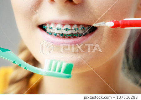Girl with teeth braces using interdental and traditional brush Girl with teeth braces using interdental and traditional brush 137310288