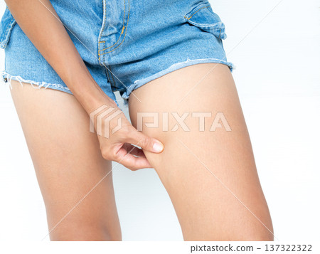 Fat thigh Cellulite Woman for Liposuction, Slim Leg Perfect Model shapely Girl, Female Diet Yoga Control Weige, Health Loss from Massage. Fat thigh Cellulite Woman for Liposuction, Slim Leg Perfect Model shapely Girl, Female Diet Yoga Control Weige, Health Loss from Massage. 137322322