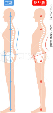 背部呈弓形且姿勢正確的女性：脊椎和骨盆 137329820