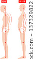 Women with hunchbacks and arched backs: spine and pelvis 137329822