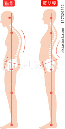 駝背和弓背的女性：脊椎和骨盆 137329822