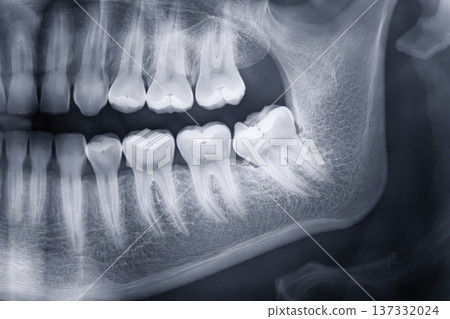 Detailed dental X-ray image showing human teeth roots and jaw bone structure Detailed dental X-ray image showing human teeth roots and jaw bone structure 137332024