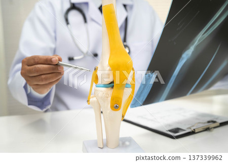 Doctor examining knee joint bone radiography xray film. Doctor examining knee joint bone radiography xray film. 137339962