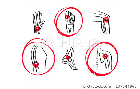 Arthritis Sketch Poster 137344965