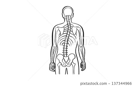 Scoliosis spine deformity 137344966
