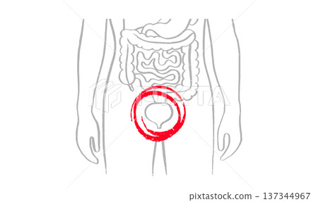Bladder inflammation pain Bladder inflammation pain 137344967