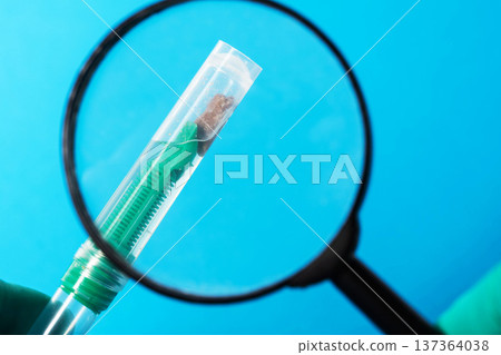 A test tube containing biomaterial and stool analysis under a magnifying glass. Concept of a stool test for fecal calprotectin, close-up 137364038