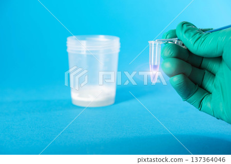 A doctor holds a medical container with ejaculate in his hand against a blue background. Conceptual illustration of a spermogram test for sperm motility and the male reproductive system. Copy space 137364046