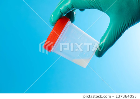 A urologist's hand holding a container of prostate fluid against a blue background. Conceptual illustration of prostate fluid microscopy, detecting leukocytes and inflammatory pathogens in the 137364053