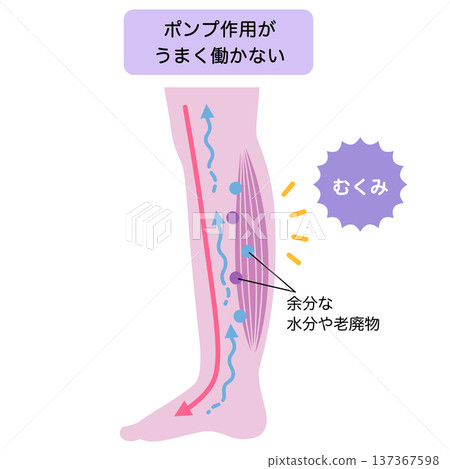 Swelling of the legs: How edema works 137367598