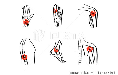 Arthritis Sketch Poster Arthritis Sketch Poster 137386161