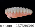 Full dental zirconium prosthesis on titanium bar stained with stains for ceramic. Lower jaw 137390390