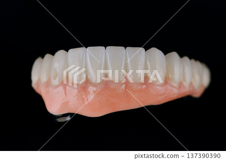 Full dental zirconium prosthesis on titanium bar stained with stains for ceramic. Lower jaw Full dental zirconium prosthesis on titanium bar stained with stains for ceramic. Lower jaw 137390390