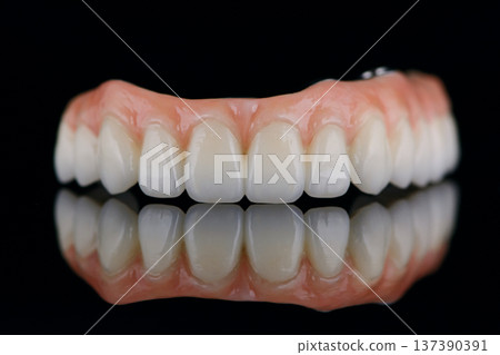 Full dental zirconium prosthesis on titanium bar stained with stains for ceramic. Upper jaw 137390391