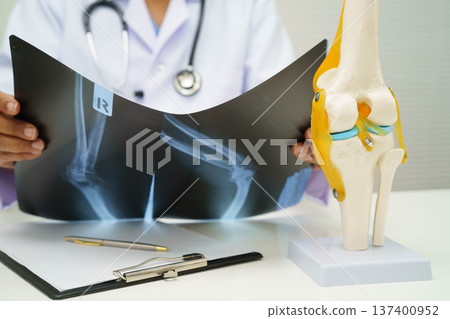 Doctor examining knee joint bone radiography xray film. Doctor examining knee joint bone radiography xray film. 137400952