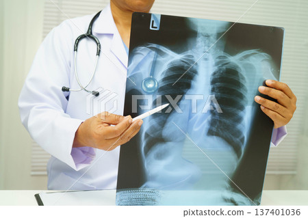 Doctor examining lung radiography xray film. Doctor examining lung radiography xray film. 137401036