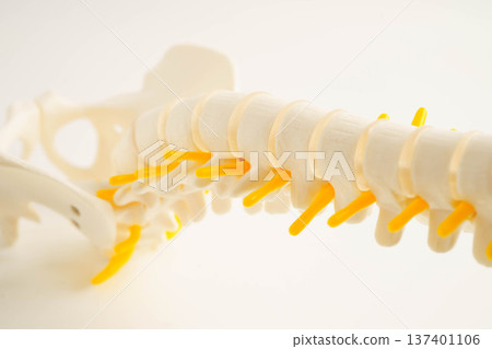 Spinal nerve and bone, Lumbar spine displaced herniated disc fragment, Model for treatment medical in the orthopedic department. Spinal nerve and bone, Lumbar spine displaced herniated disc fragment, Model for treatment medical in the orthopedic department. 137401106