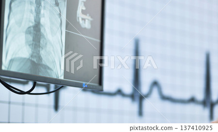 Medical monitor showing a chest x-ray and ecg heart rate results in a hospital Medical monitor showing a chest x-ray and ecg heart rate results in a hospital 137410925
