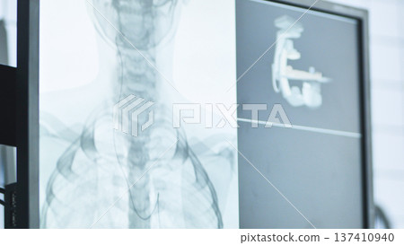 Medical imaging display showing human chest x-ray with an inserted catheter wire Medical imaging display showing human chest x-ray with an inserted catheter wire 137410940