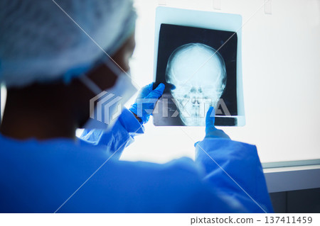 Brain xray, medical doctor and surgery charts, test results and healthcare analysis of the head. Radiology, neurology and surgeon check skull x ray, anatomy and review mri for hospital operation 137411459