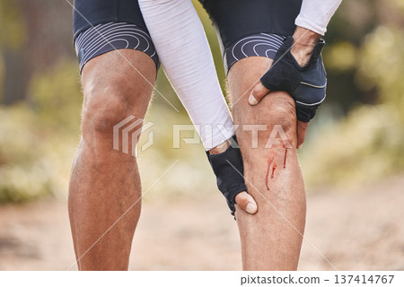Fitness, knee pain and man with blood, injury or sports mistake in park for cycling, training or exercise accident. Bleeding, wound and cyclist with biking fail, joint or leg emergency or broken bone Fitness, knee pain and man with blood, injury or sports mistake in park for cycling, training or exercise accident. Bleeding, wound and cyclist with biking fail, joint or leg emergency or broken bone 137414767
