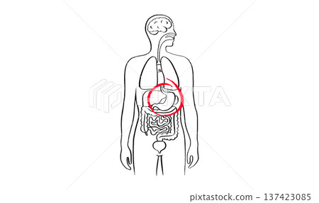 Gastroesophageal reflux pain 137423085