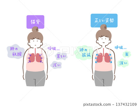 A comparison illustration set of a woman with hunched back and contracted lungs and a woman with correct posture and expanded lungs 137432109