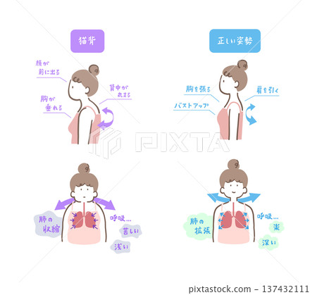 A comparison illustration set of a woman with hunched back and contracted lungs and a woman with correct posture and expanded lungs 137432111