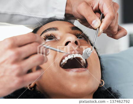 Mouth, face of woman and dentist with tools for dental, healthcare, assessment and test in clinic. Oral wellness, orthodontics and patient with medical doctor, mirror and excavator for teeth cleaning Mouth, face of woman and dentist with tools for dental, healthcare, assessment and test in clinic. Oral wellness, orthodontics and patient with medical doctor, mirror and excavator for teeth cleaning 137462792