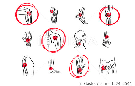 Arthritis Sketch Poster 137463544