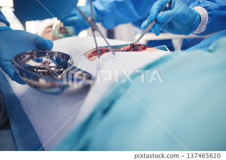 Surgery, team hands and patient operation, hospital emergency or group of doctors help, support or healing wound. Accident injury blood, medical tools and healthcare surgeon teamwork on saving person Surgery, team hands and patient operation, hospital emergency or group of doctors help, support or healing wound. Accident injury blood, medical tools and healthcare surgeon teamwork on saving person 137465620