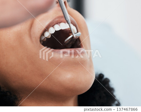 Mouth, teeth of woman and dentist with tools for dental cosmetics, healthcare assessment and test in clinic. Oral service, orthodontics and closeup of patient, mirror and excavator for tooth cleaning 137467866