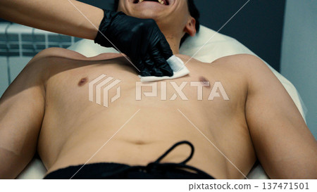 Close up of a man receiving cosmetic chest treatment Close up of a man receiving cosmetic chest treatment 137471501