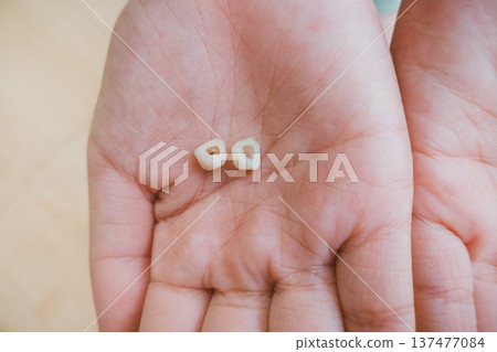 箍牙 牙齒 齒輪 137477084
