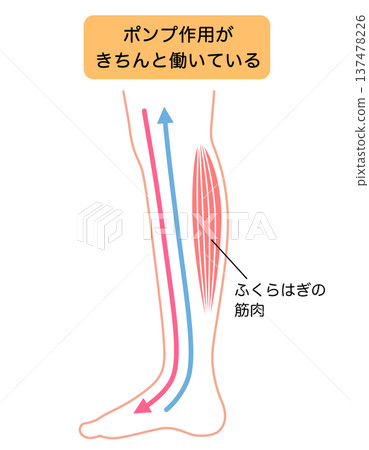 腿部腫脹:水腫的成因 腿部腫脹:水腫的成因 137478226