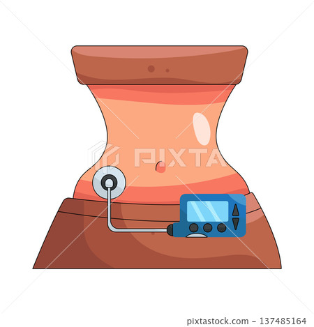 Illustration of woman using an insulin pump 137485164