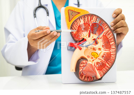Chronic kidney disease, doctor with model for treatment urinary system, urology, Estimated glomerular filtration rate eGFR. Chronic kidney disease, doctor with model for treatment urinary system, urology, Estimated glomerular filtration rate eGFR. 137487557