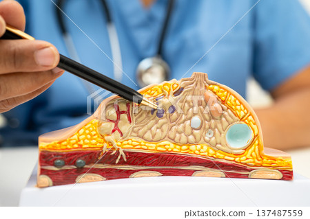 doctor holding female breast human anatomy model. 137487559