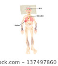 肺炎全身表現圖解 | 一目了然地展現臥床老年病患病情的醫學圖示 137497860