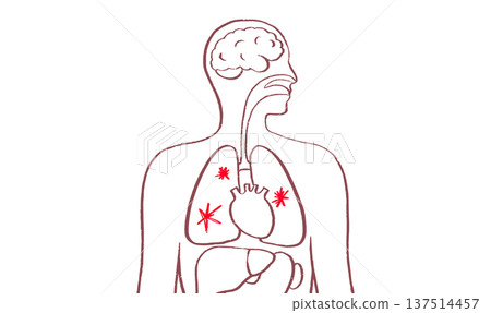Lung disease concept 137514457