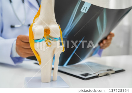 Doctor examining knee joint bone radiography xray film. Doctor examining knee joint bone radiography xray film. 137528564