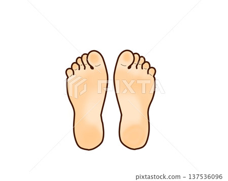 Hallux valgus Hallux valgus 137536096