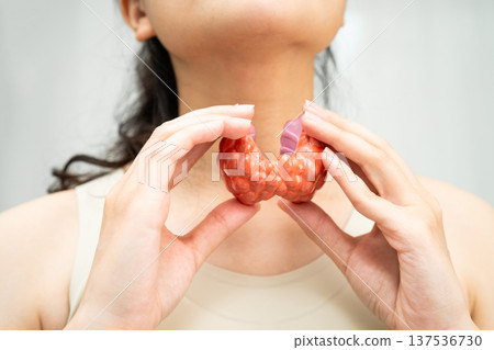 Hyperthyroidism, Overactive Thyroid, Thyroid Lymphoma, Asian woman with thyroid gland human anatomy model. 137536730
