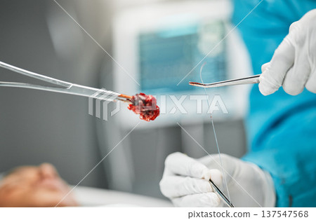 Surgery, doctors hands on tools and stitches with equipment, teamwork and support in hospital. Nurse helping medical surgeon, blood and patient in bed for safety, operation and emergency care in ER. 137547568