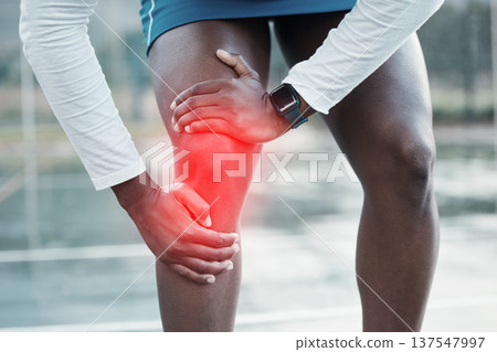 Person, hands and knee injury in sports accident, training or muscle inflammation from outdoor workout. Closeup of athlete with leg pain, joint ache or arthritis after running, exercise or cardio Person, hands and knee injury in sports accident, training or muscle inflammation from outdoor workout. Closeup of athlete with leg pain, joint ache or arthritis after running, exercise or cardio 137547997